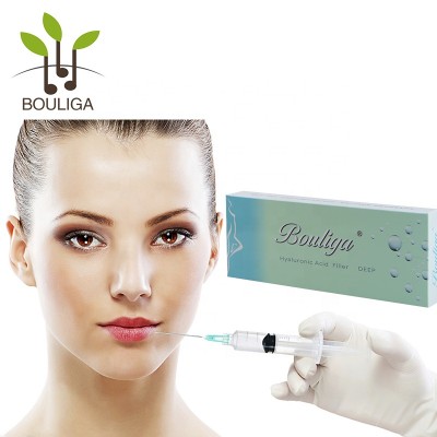 No skin test needed body hyaluronic acid for recontouring the lips